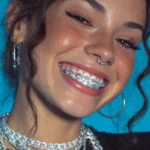 How to Clean Diamond Grillz