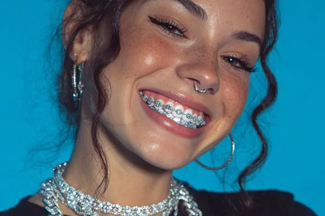 The 7-Step Diamond Grillz Cleaning Method