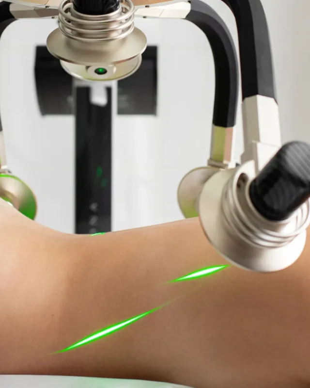 hip dip surgery cost: All you need to know