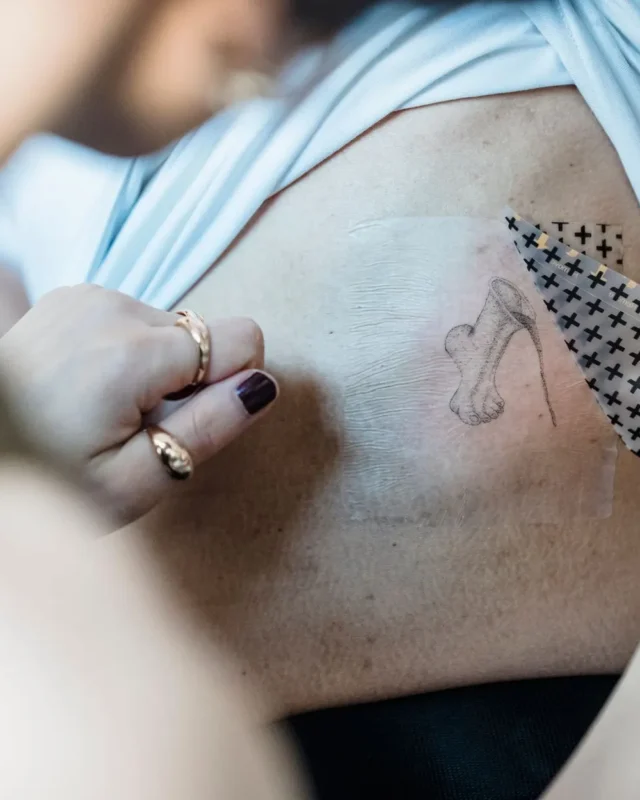 Famous Tattoo Removals That Sparked a Trend